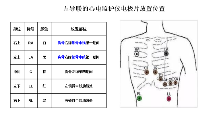 五导联的心电监护仪电极片放置位置